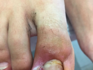 Pedilab, Pedilab Budapest, pedikűr, pedikűr Budapest, pedikűrös, pedikűrös Budapest