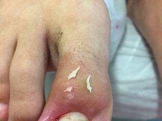 Pedilab, Pedilab Budapest, pedikűr, pedikűr Budapest, pedikűrös, pedikűrös Budapest