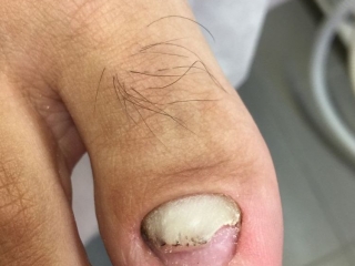 Pedilab, Pedilab Budapest, pedikűr, pedikűr Budapest, pedikűrös, pedikűrös Budapest